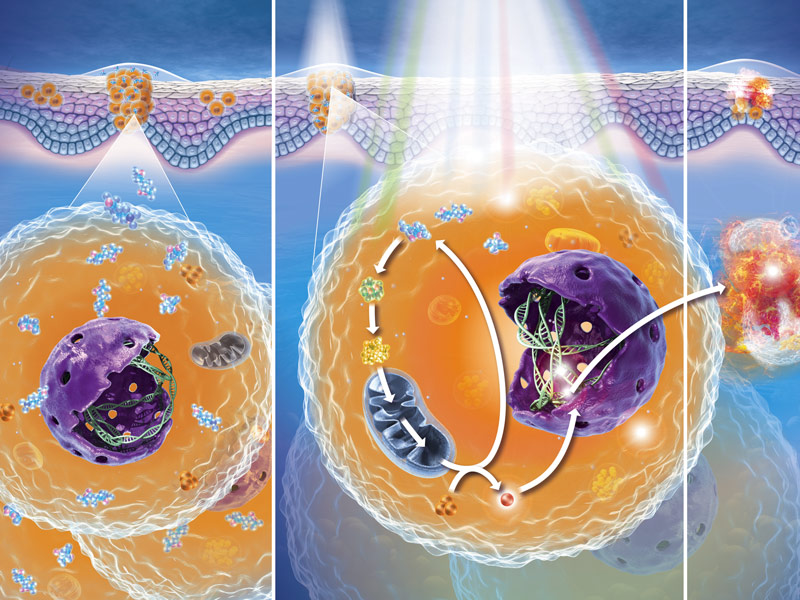 CANCER DE LA PEAU | METVIX