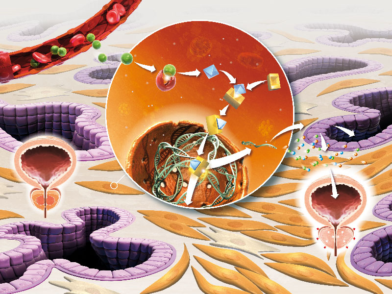 Hypertrophie Prostate