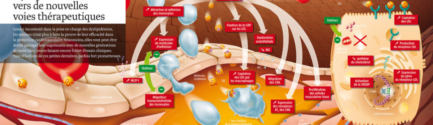 illustration-medicale-scientifique-didactique-dyslipidemies