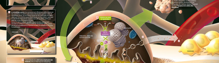 illustration-medicale-scientifique-didactique-osteoporose