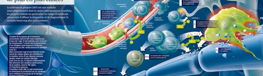 illustration-medicale-scientifique-didactique-scelrose-plaques-physiopathologie