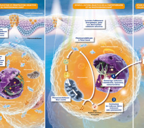 illustration-medicale-scientifique-3D-peau-cancer-melanome-metvix