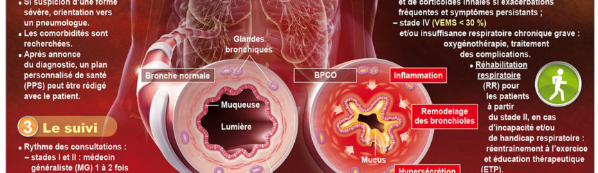 illustration-medicale-scientifique-BPCO