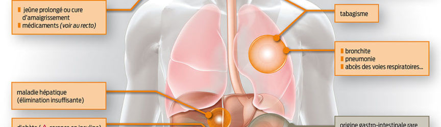 illustration-medicale-scientifique-halitose-gastro-intestinal-mauvaise-haleine