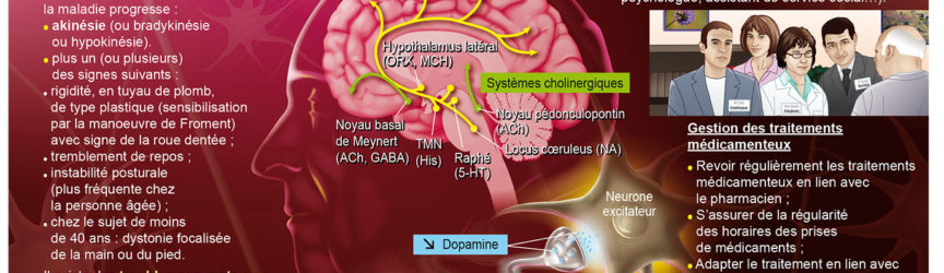 illustration-medicale-scientifique-parkinson-pathologie-maladie-symptome