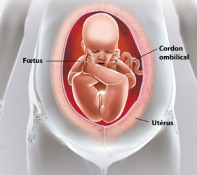 illustration-medicale-scientifique-ramsay-ramsay-accouchement-siege-femme-enceinte