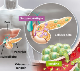 illustration-medicale-scientifique-ramsay-type-diabete-pancreas-insuline