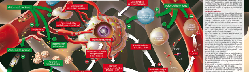 illustration-scientifique-medicale-oncologie-cancers-sein-metastase-tumorale-presse-magazine