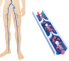 Illustration en deux parties représentant un retour veineux normal. D'une part, sur la gauche, une vue globale des veines à l'échelle des jambes, et d'autres part, sur la droite, une vue en coupe d'une veine.