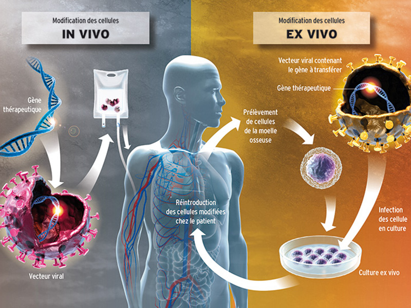 La thérapie génique